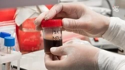 Глава Ставрополья стал донором крови для участников СВО и жителей ЛНР